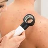 Dəriniz üçün ən yaxşı dermatoloqu necə seçmək olar?