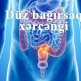 Duz bagirsaq xercengi