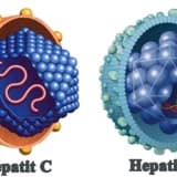 Müxtəlif etiologiyalı hepatitlər