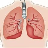 Pulmonar tromboendarterektomiya haqqında