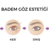 Badam Göz Estetiği