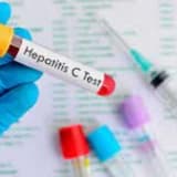 Hepatit C-nin zamanında düzgün müalicəsi