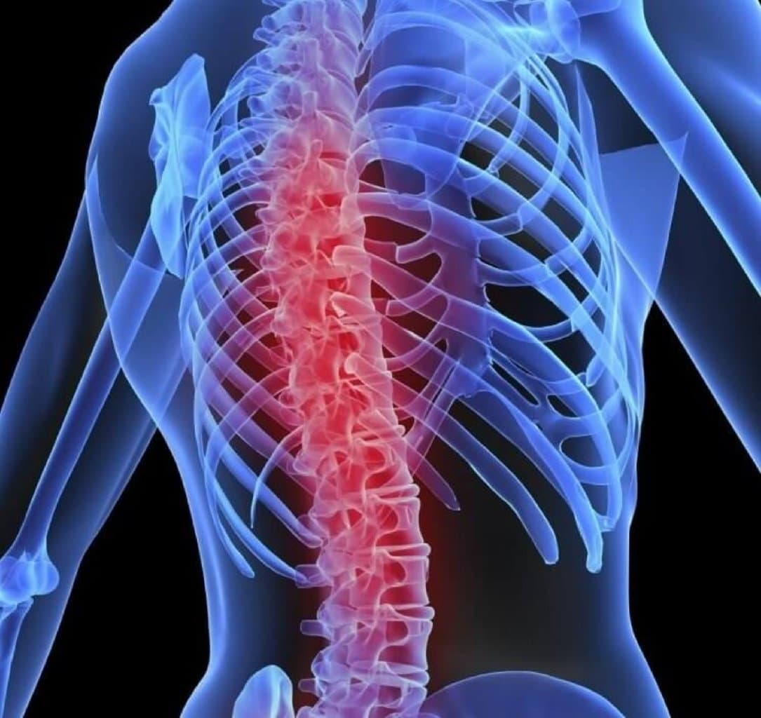 Onurganin inkisaf anomaliyalari