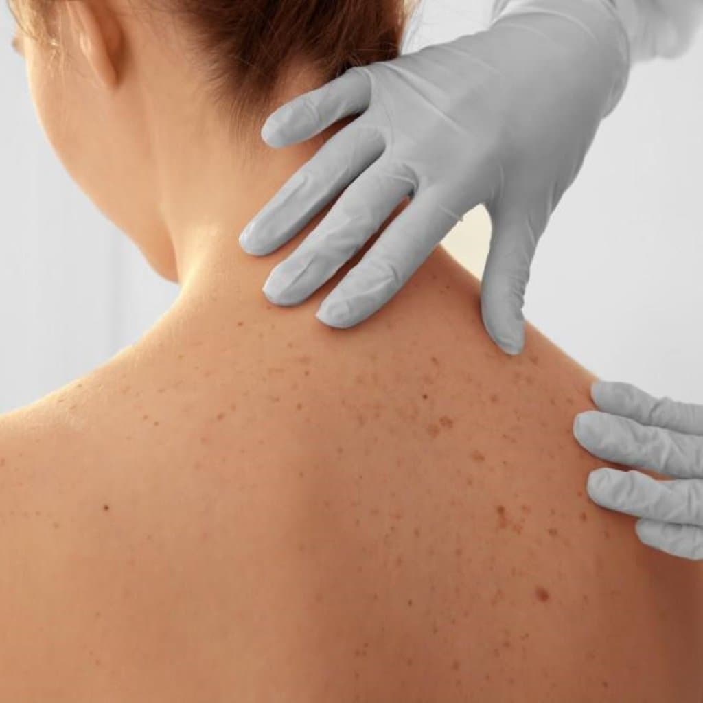 Dəri və Yumşaq Toxuma Əməliyyatları: Tərif, Növləri və Tətbiq Edilmə Səbəbləri