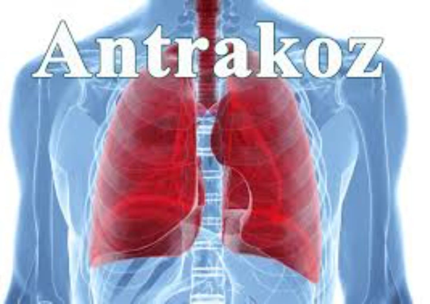 Antrakoz
