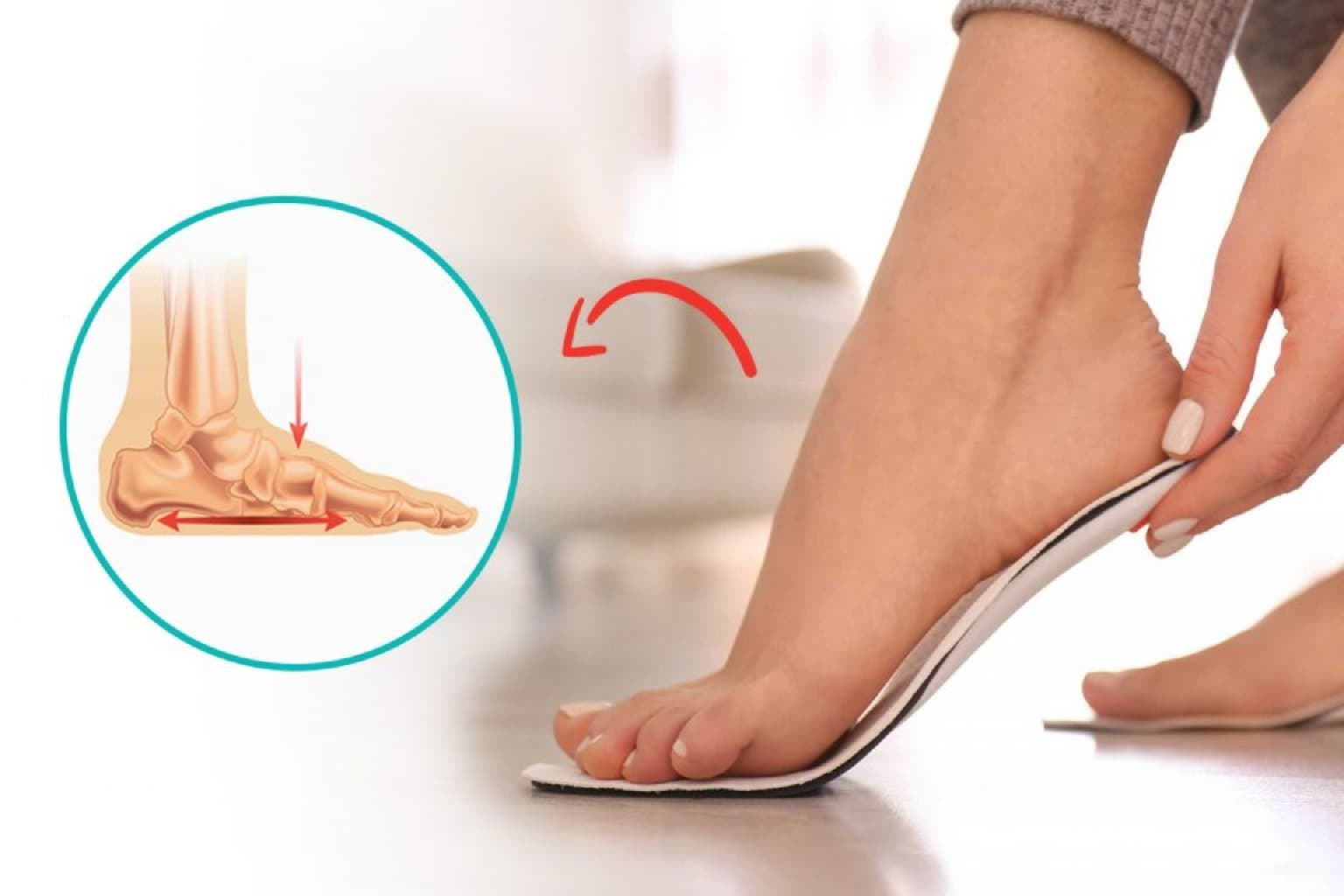 Düzdabanlıq nədir?