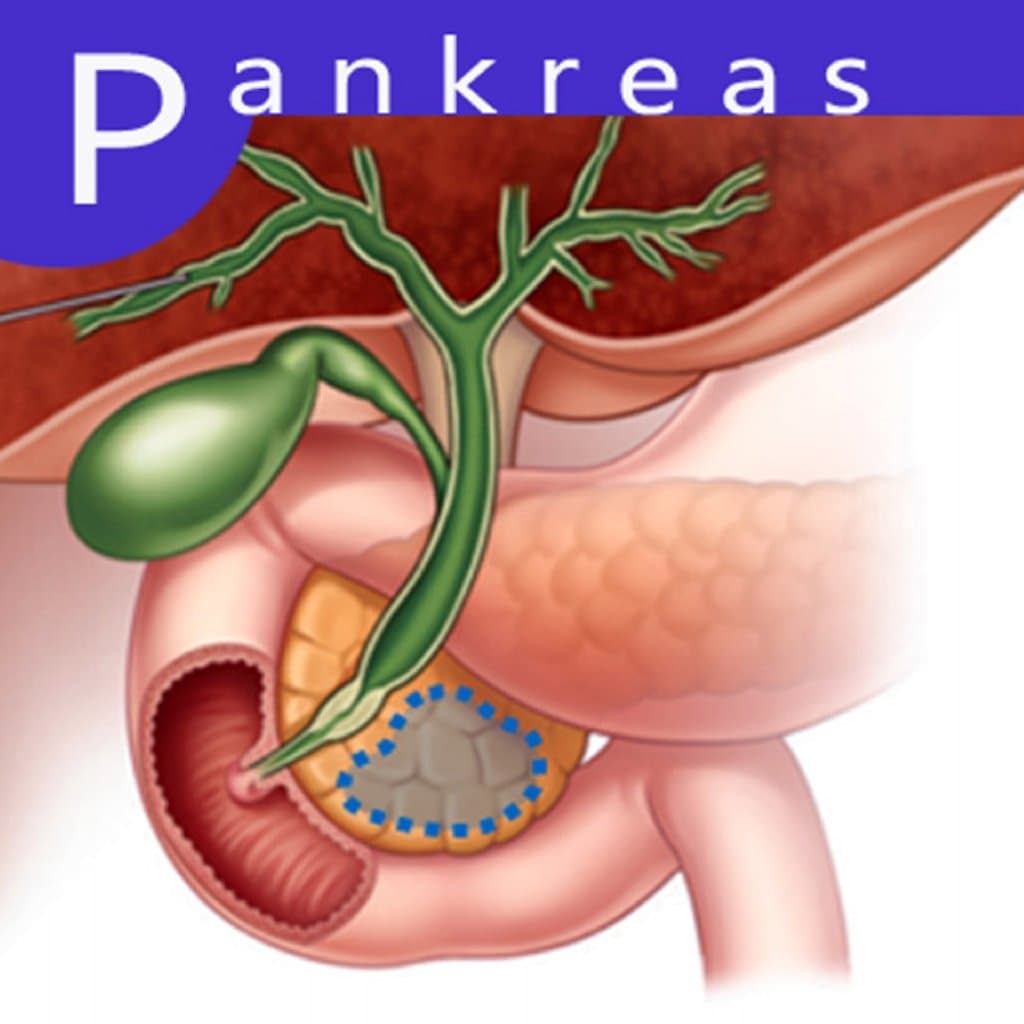 Pankreas Cərrahiyyəsi: Prosedur, Səbəblər və Nəticələr