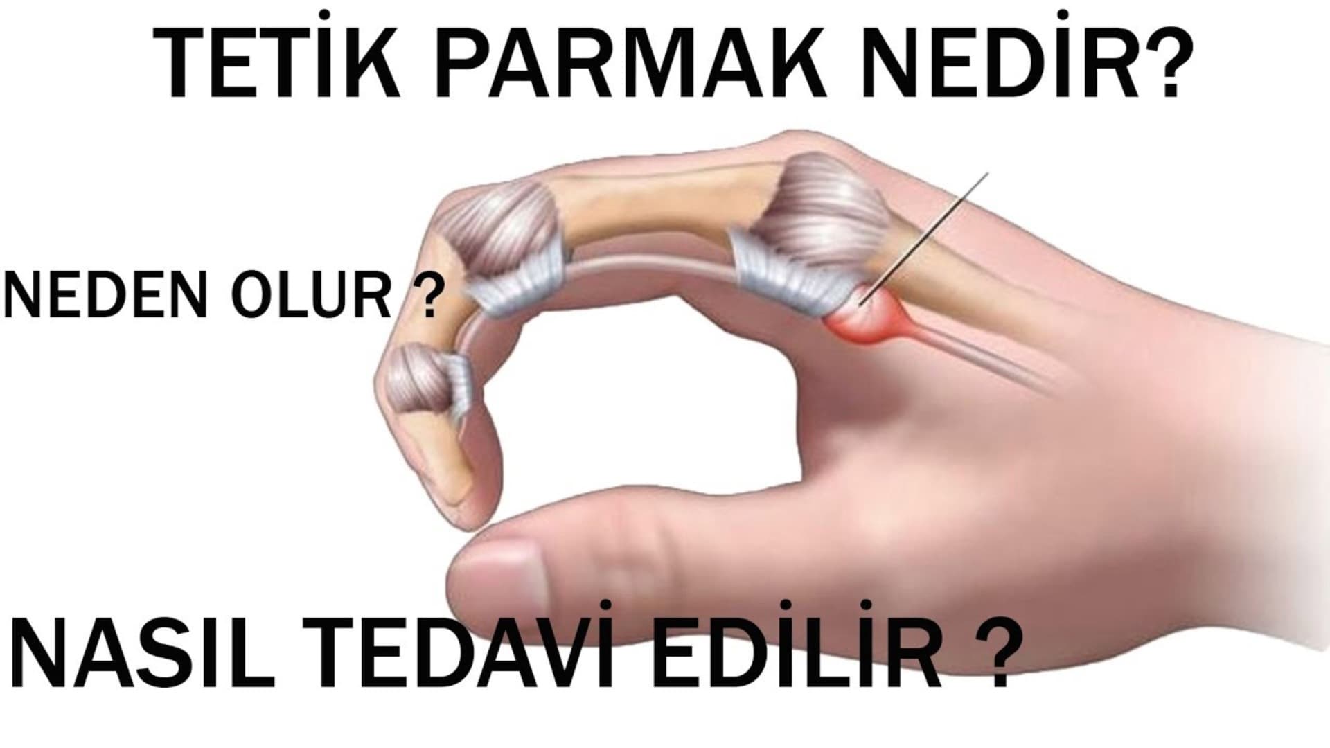 Tətik Barmaq nədir?