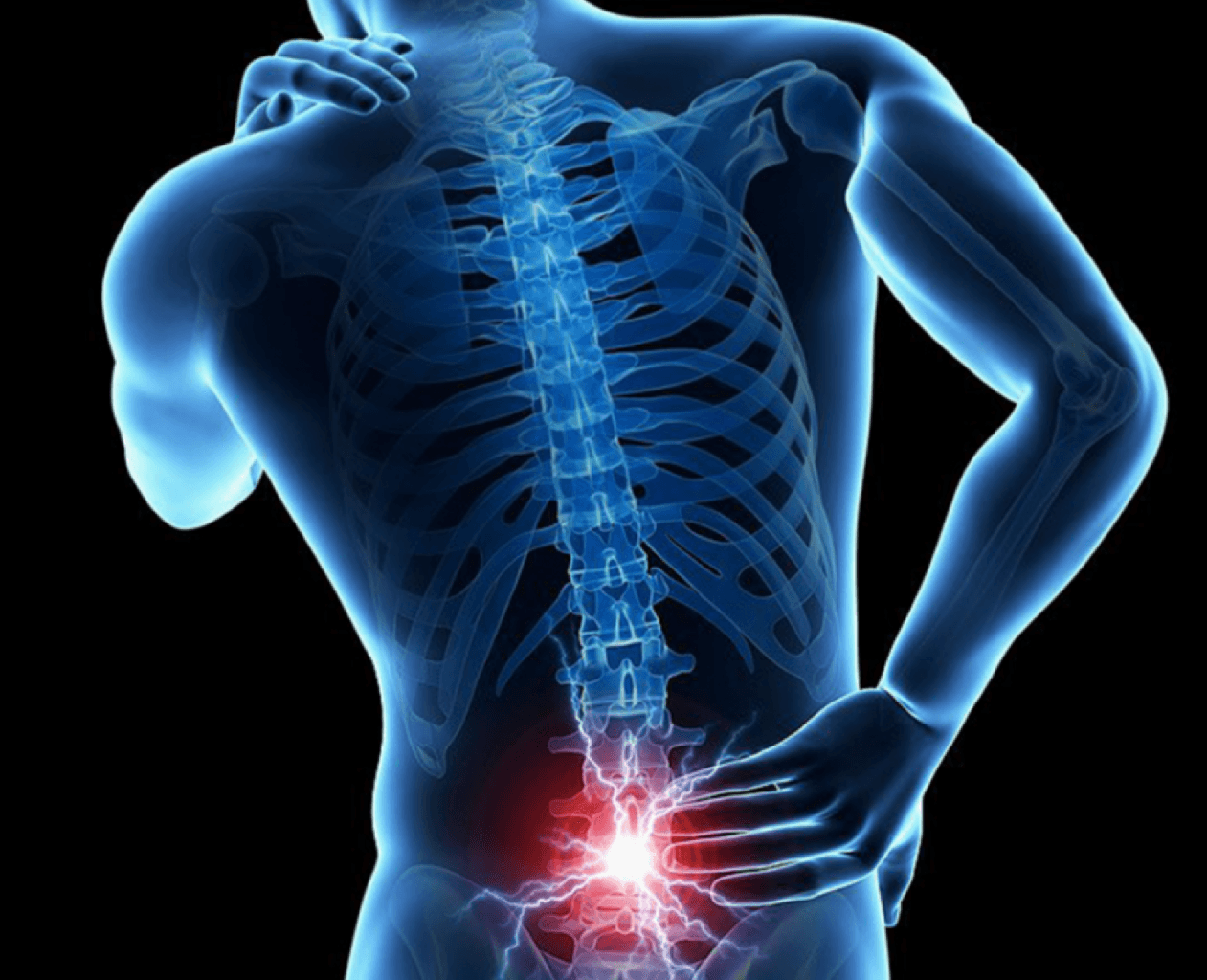 Bel yırtığı ağrılarından əməliyyatsız xilas olmaq mümkündür!