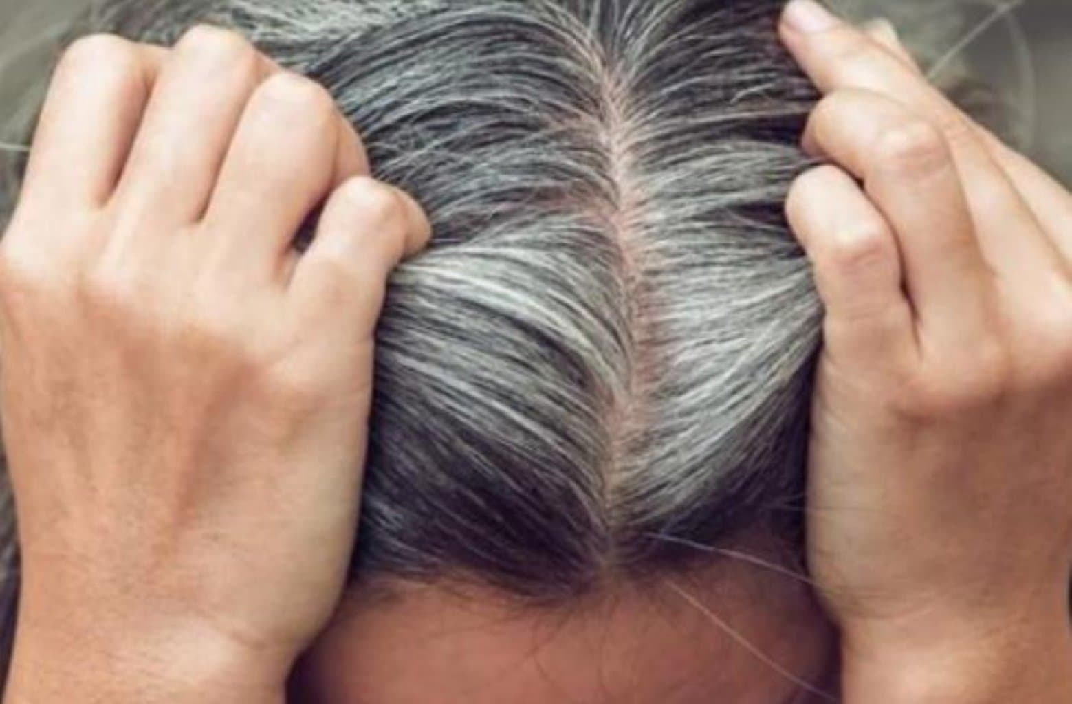 Saçlarımız niyə vaxtından tez ağarır?