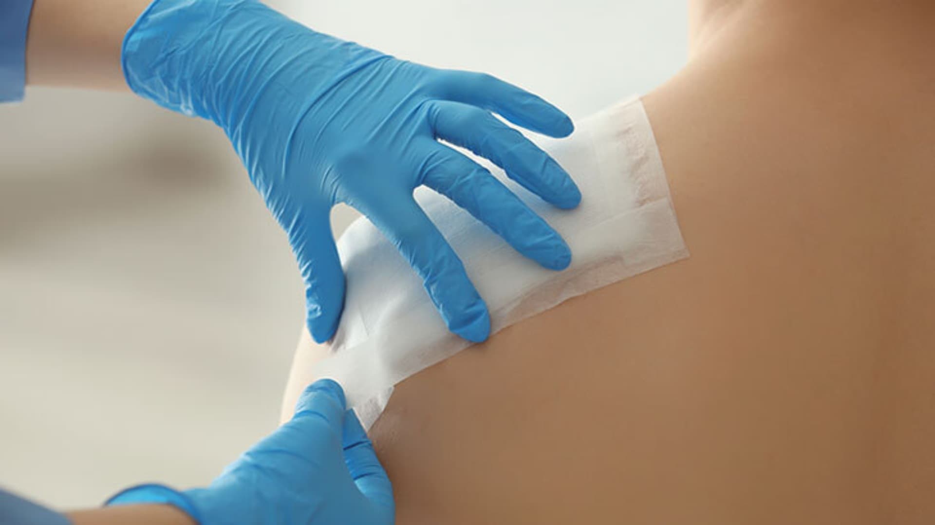 Əməliyyatdan sonrakı ödem haqqında bilməli olduğunuz şey: əməliyyatdan sonrakı ödemin mümkün səbəbləri və müalicəsi