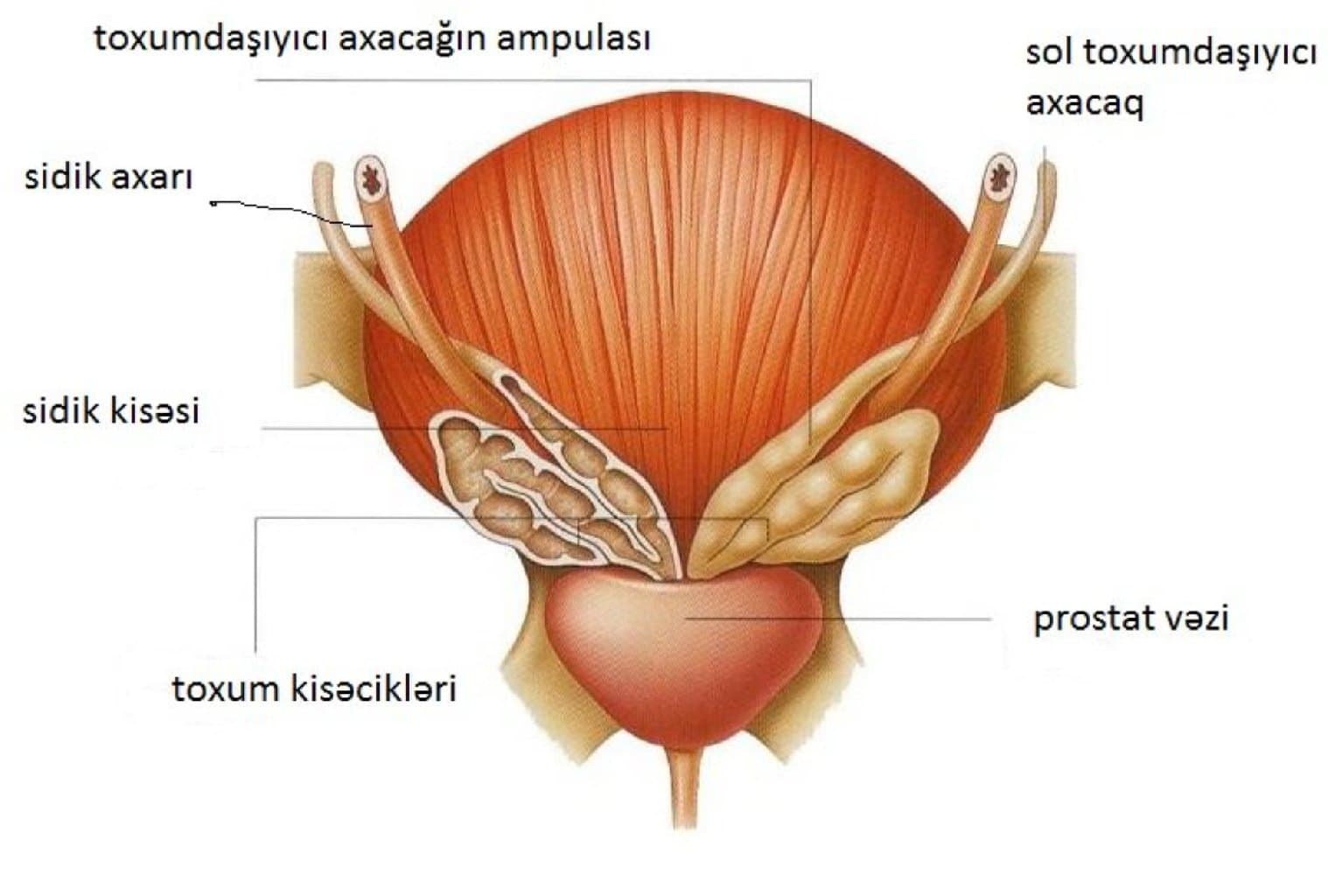 Prostat vəzinin absesinin yaranma səbəbi