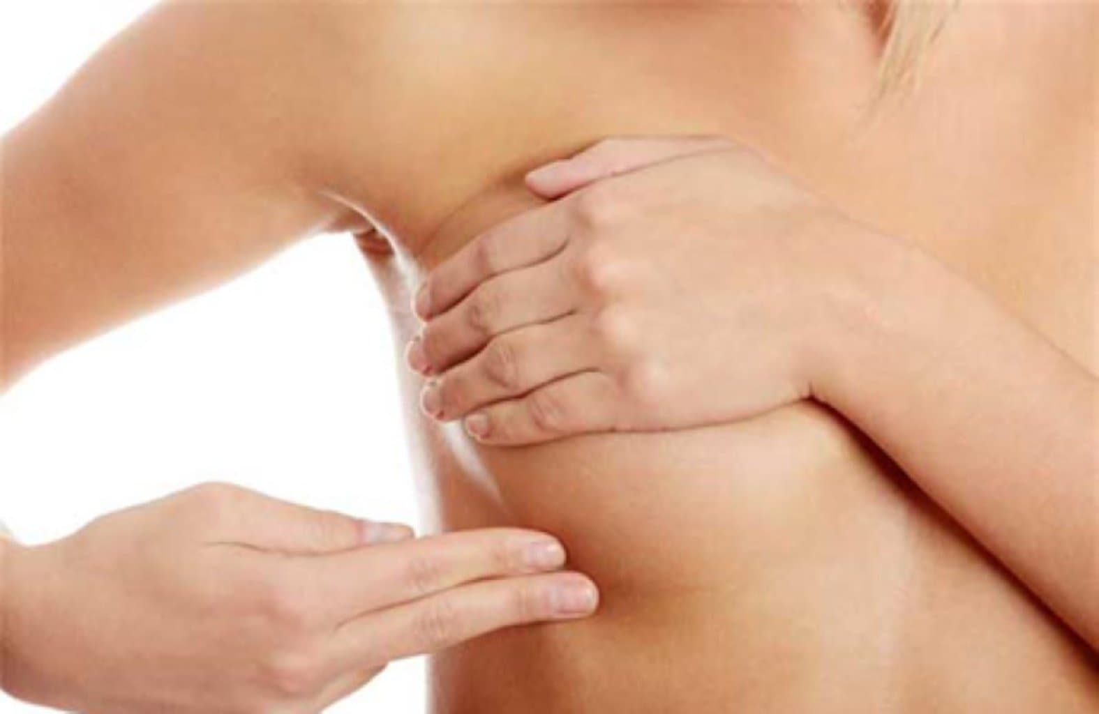 Döş Xəstəlikləri: Tərif, Növləri və Müalicə Yolları