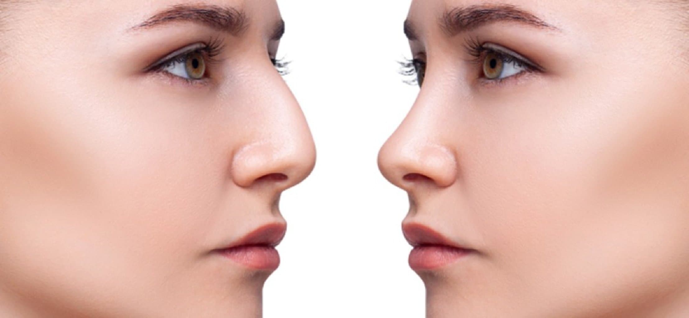 Burun estetikası - Rinoplastika nədir? Cərrahiyyə haqqında hər şey