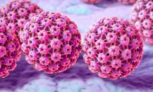 İnsan papillomavirusu (hpv) nədir? semptomlar, müalicə və profilaktika