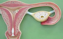 Endometriyanın diaqnostik qaşınması
