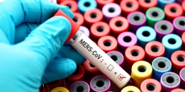 Mers nədir? semptomlar, müalicə və profilaktika haqqında ən son məlumatlar