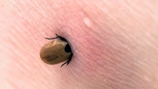 Lyme xəstəliyi: simptomlar, diaqnoz və müalicə