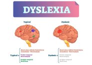Disleksiya növləri, Əlamətləri və müalicə üsulları
