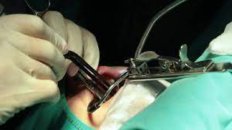Endoskopik,laparoskopik cərrahi əməliyyatlar