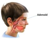 Adenoidlər