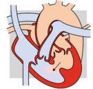 Aorta-pulmoner pencere