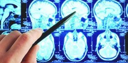 Onurğa beyni şişləri (spinal tümorlar): tərif, səbəbləri və müalicə yolları