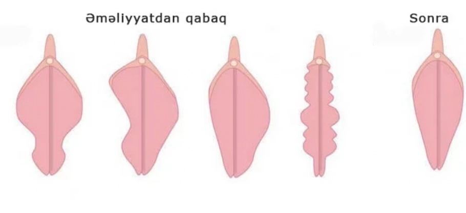 Hammomdagi ogizda bexosdan