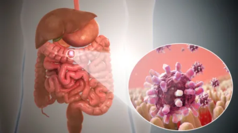 Enterit xesteliyi