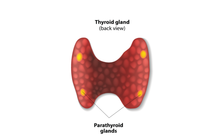 Paratiroid hormon yüksəkliyi (hiperparatiroidi)