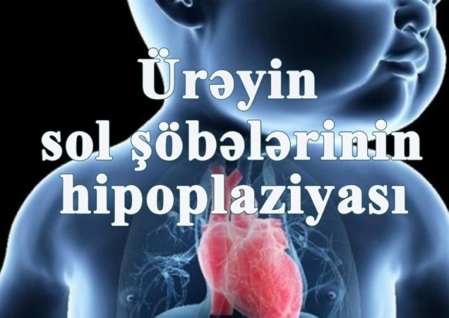 Üreyin sol sobelerinin hipoplaziya sindromu