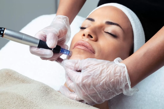 Dermapen tətbiqi