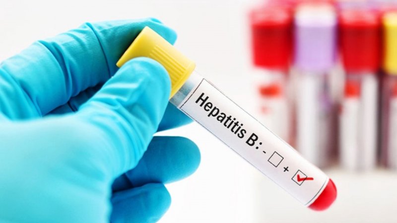 Hepatit: simptomlar, növlər və müalicələr-qaraciyər sağlamlığı üçün nələri bilməlisiniz