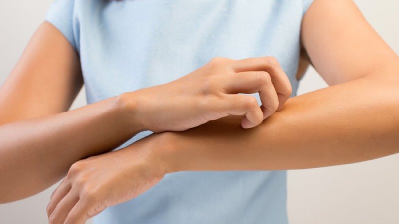 Qaşıntı (pruritus)