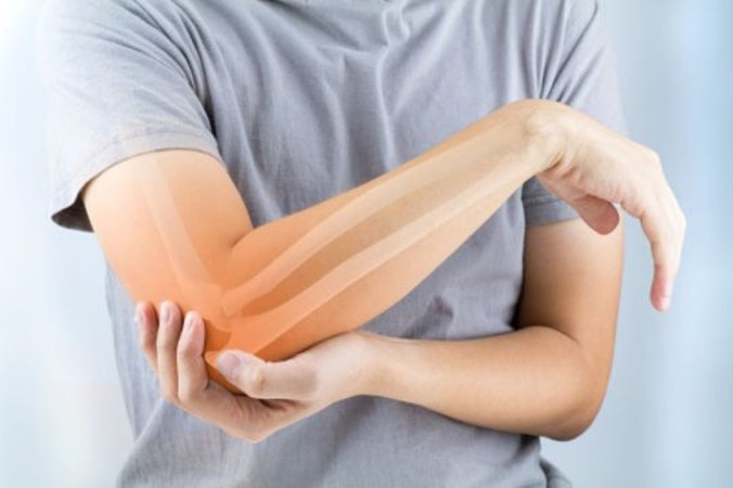 Sümük əriməsinə (osteoporoz) bağlı ağrılar