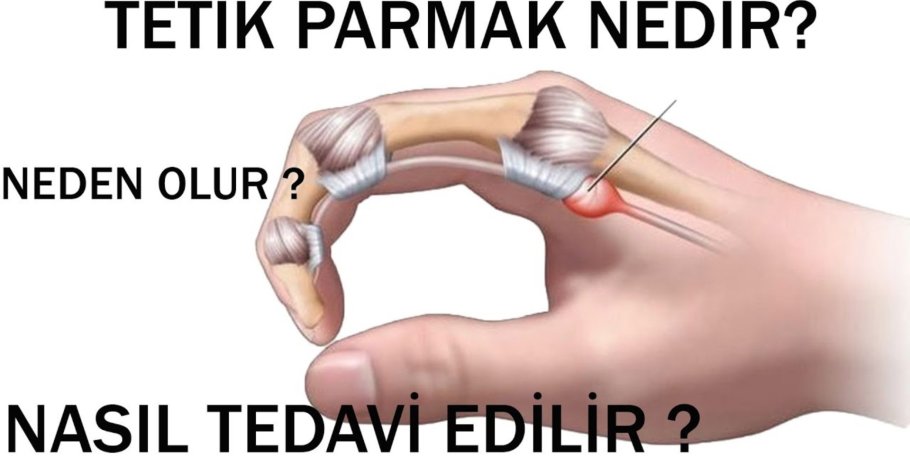 Tətik barmaq nədir? Onlayn görüş