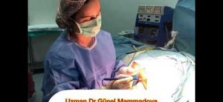 Uzman cerrah mammoloq Dr.Gunel Memmedova