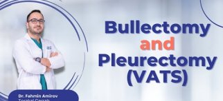 Bullectomy and Pleurectomy (VATS)